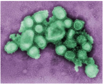 Virus H1N1