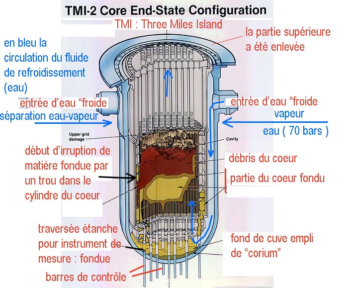 coeur TMI